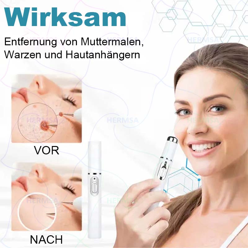 Hermsa® non-invasive laser pointer - mole and wart removal (🔥Last day 50% off)