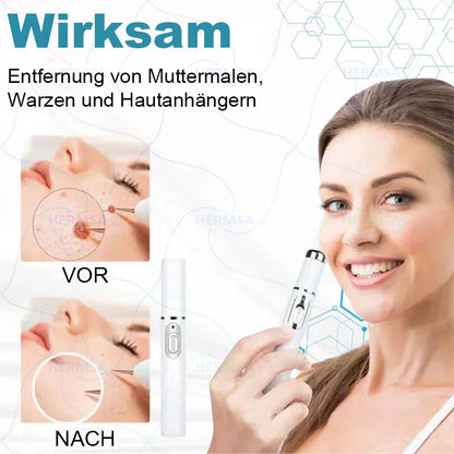 Hermsa® non-invasive laser pointer - mole and wart removal (🔥Last day 50% off)